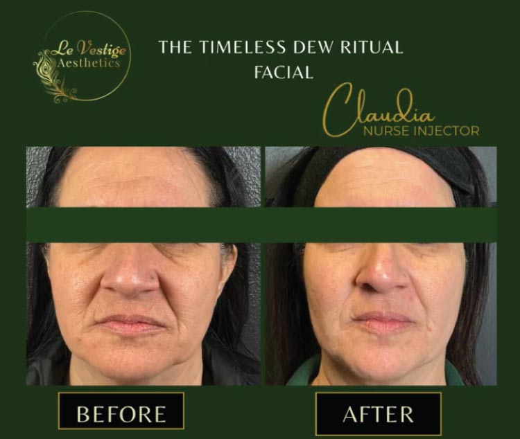 preime dermafacial treatment in a luxury setting in hanford ca