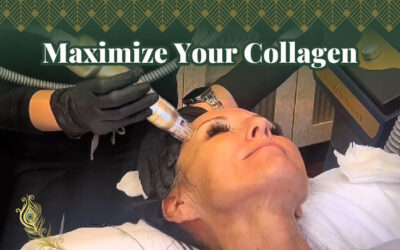 How Long Does Microneedling Last?