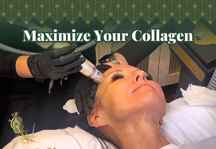 How Long Does Microneedling Last? Maximize Your Collagen